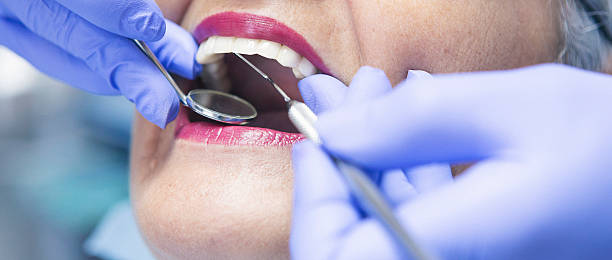 Best Urgent Dental Care for Toothaches in Hyattsville, MD